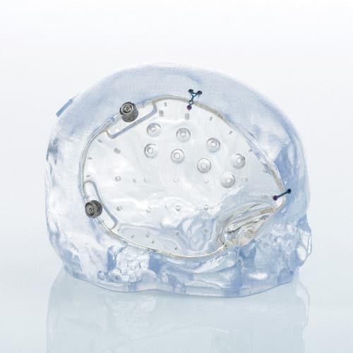 Patientenspezifische Implantate-Produktbild Vergrößerung CW