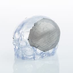 Patientenspezifische Implantate-Produktbild Vergrößerung CW