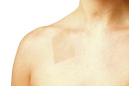 Scar Repair application-Scar Repair application night chest