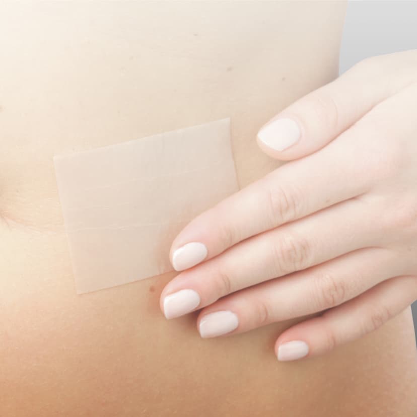 Scar Repair application-Scar Repair application belly 2