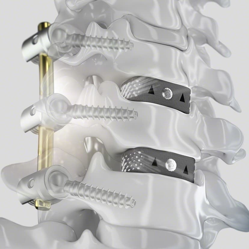 CeSPACE® 3D-Produktbild CW Vergrößerung