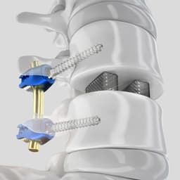 PROSPACE® 3D-Produktbild CW Vergrößerung