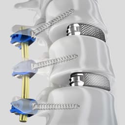 TSPACE® 3D-Produktbild CW Vergrößerung