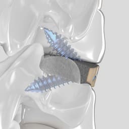 Arcadius XP C®-Product Picture