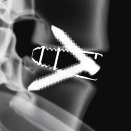 Arcadius XP L®-Produktbild