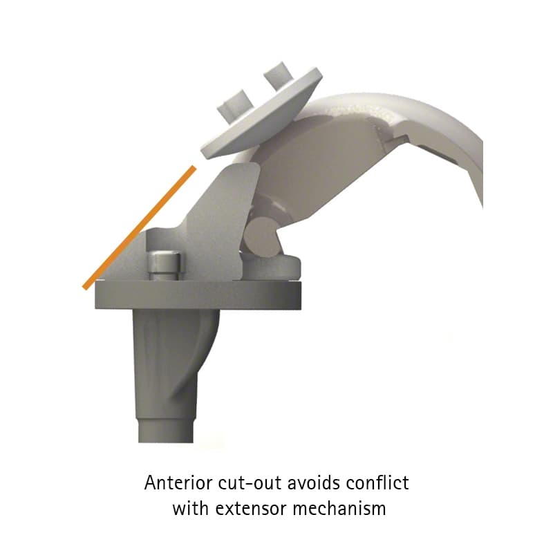 VEGA System®-Produktbild Web Vergrößerung