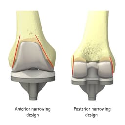 VEGA System®-Produktbild Web Vergrößerung