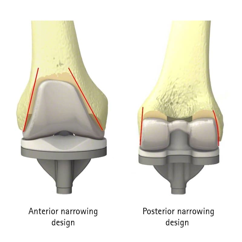 VEGA System®-Produktbild Web Vergrößerung