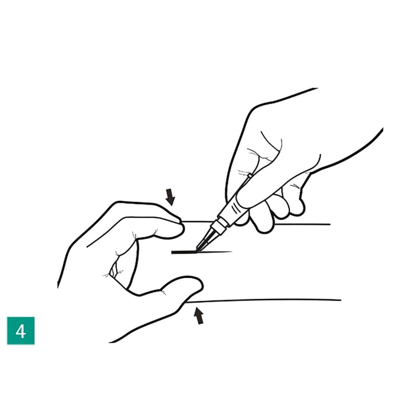 Histoacryl® Octyl Fig. 4-Produktbild CW Vergrößerung